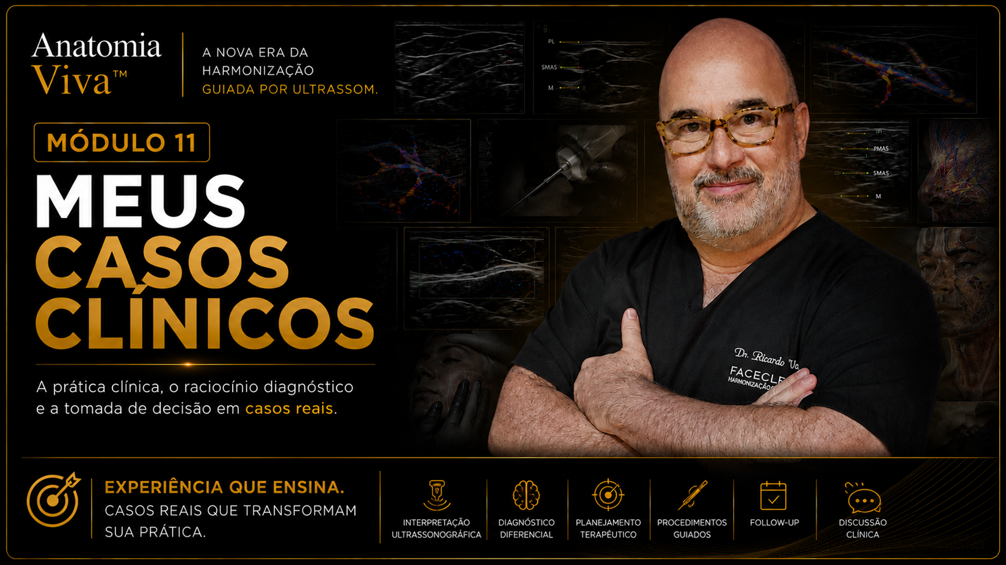 Módulo 11 — Meus Casos Clínicos: mosaico com 15 casos ultrassonográficos reais (fossa piriforme, infraorbital, amaurose, região temporal, mento, lábios, malar, PMMA, artéria labial inferior, nódulo inflamatório, bloqueio linfático, excesso de preenchedor, artefato de espelhamento) com análise completa.