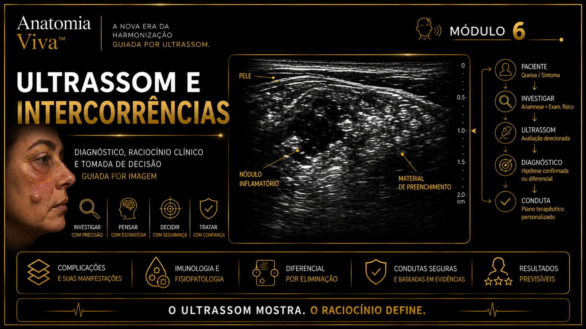 Módulo 6 — Intercorrências em Harmonização Facial: transdutor L18-5 sobre face com processo inflamatório e imagem anotada mostrando edema, nódulo inflamatório, coleção líquida, vasos reacionais e tecido adjacente.